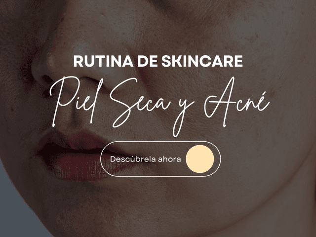 Rutina para Piel Seca y con Acné